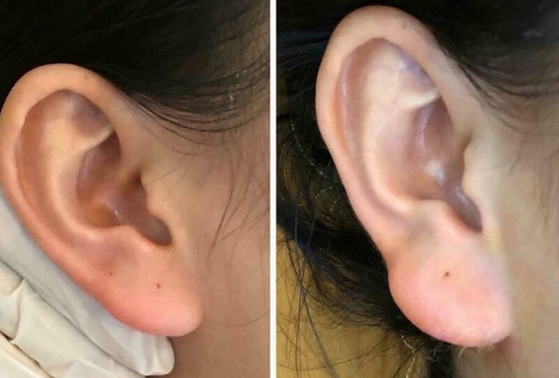 Các tướng tai phụ nữ giàu sang